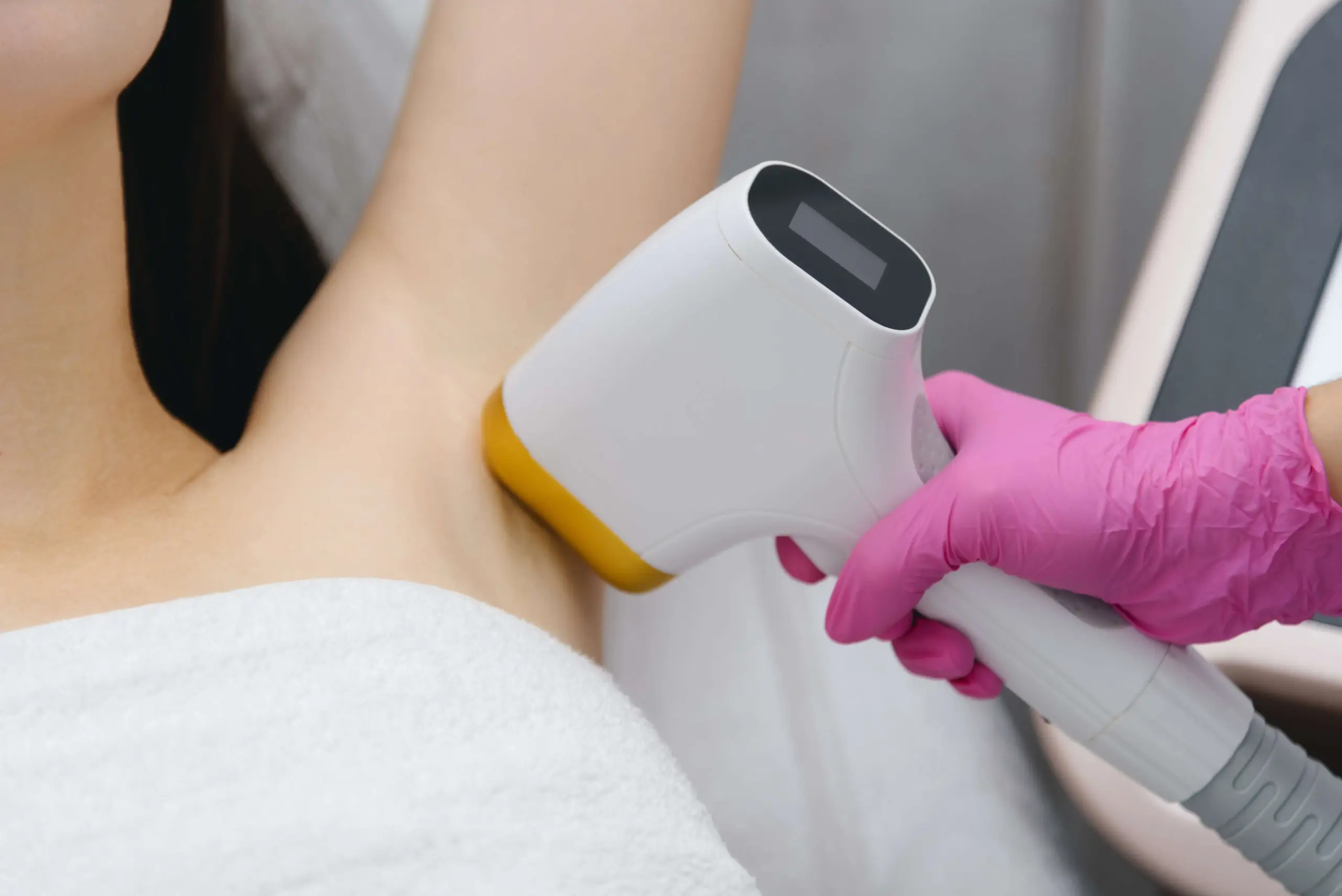 ipl-hair-epilux-die-hautaestheten